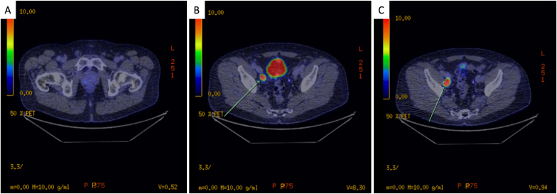 Fig. 2