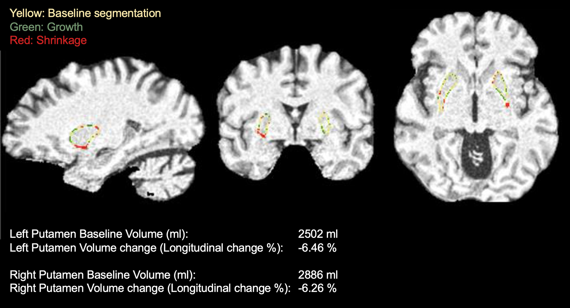 Figure 3 –