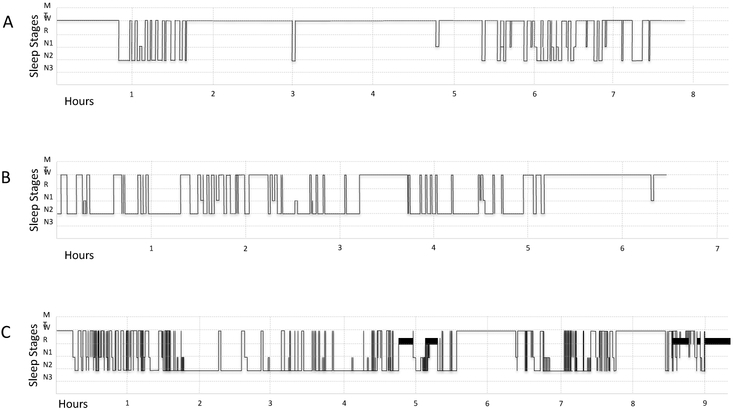 Figure 1: