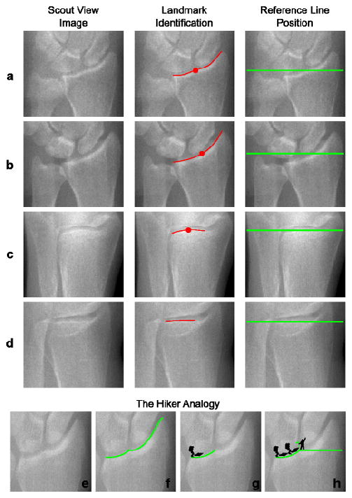 Figure 1A