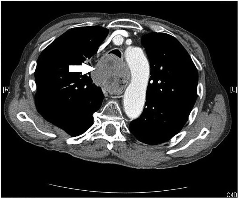 Figure 1