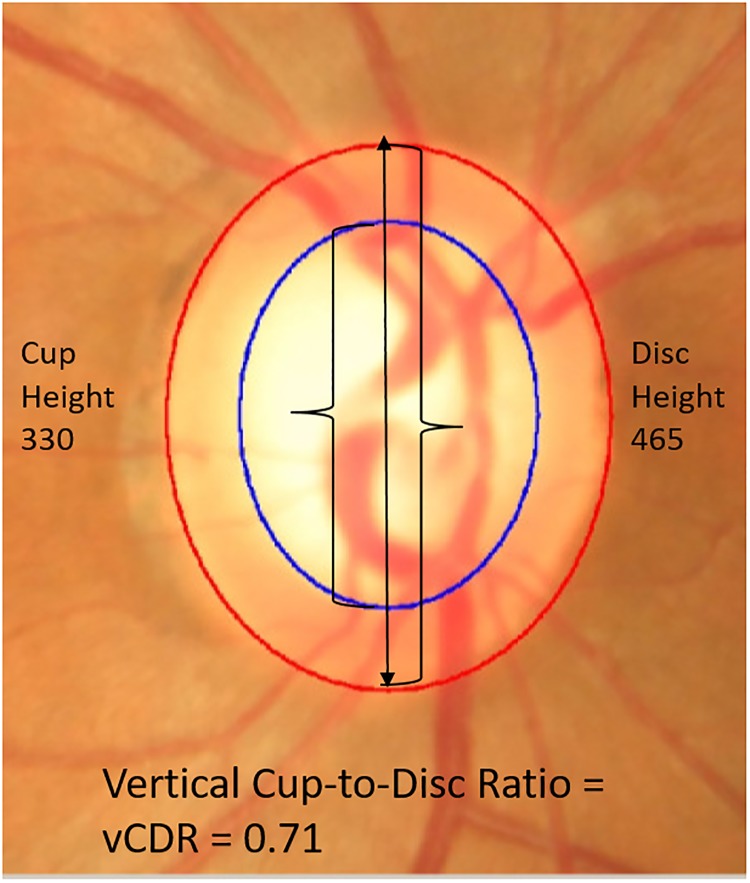 Fig 1