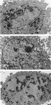 Figure 11.