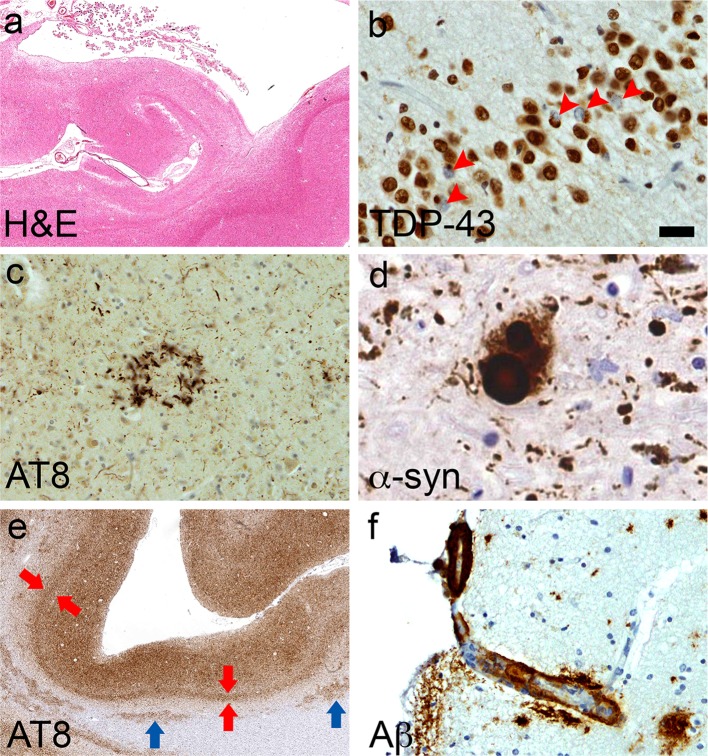 Fig. 3