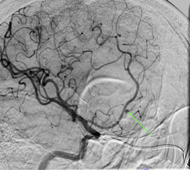 FIG. 3.