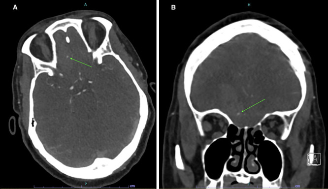 FIG. 2.