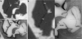 Fig. 14