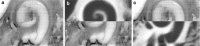 Fig. 13