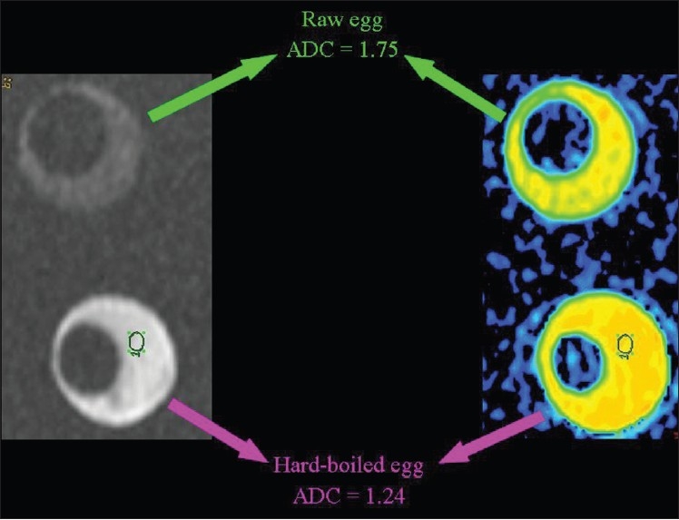 Figure 17