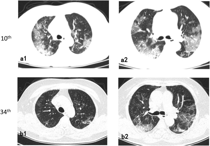 Fig. 1
