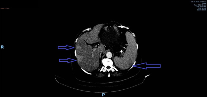 FIGURE 2