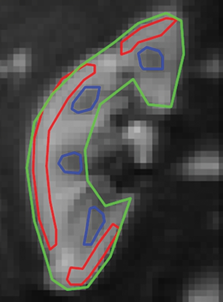 Figure 2a: