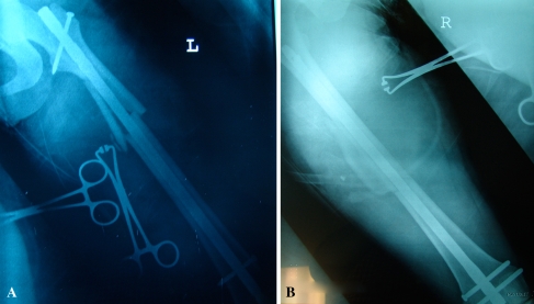 Fig. 2A–B