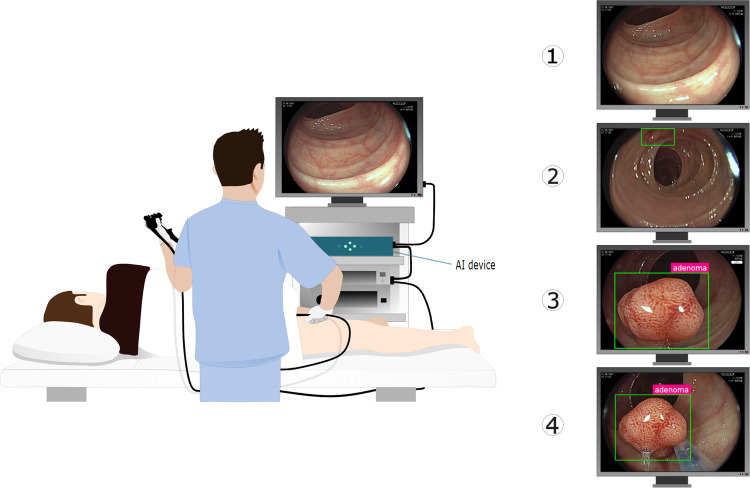 Fig. 1