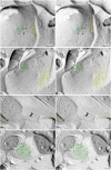 Fig. 13