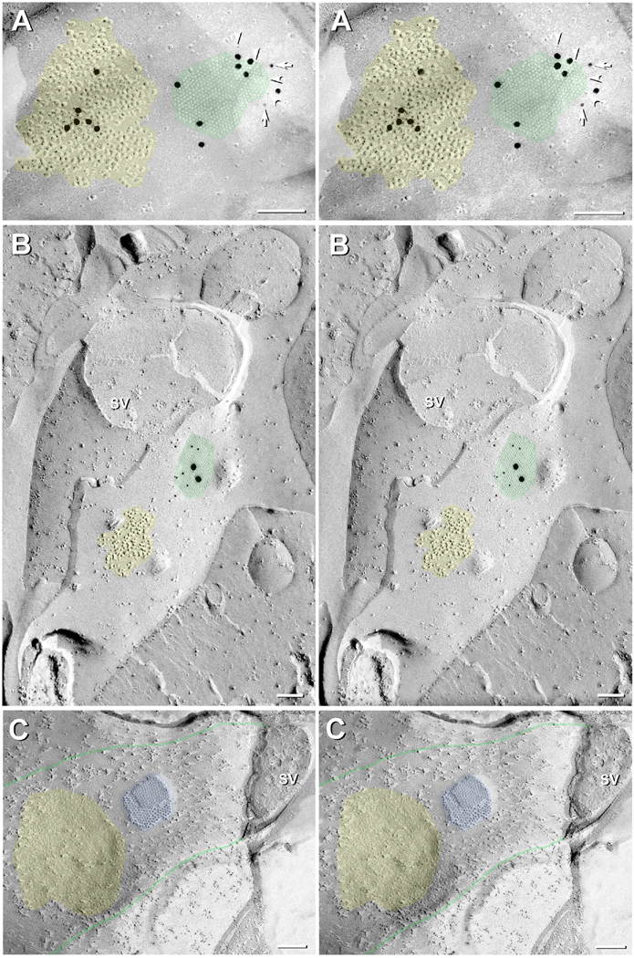 Fig. 11