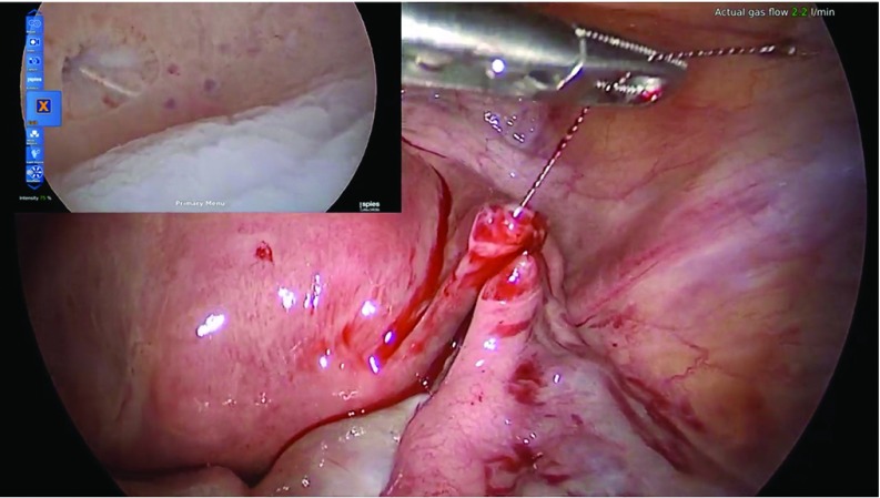 Figure 2.