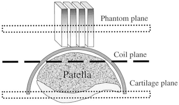 FIG. 1