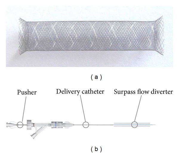 Flow Diverters for Intracranial Aneurysms - PMC