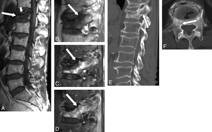 Fig 2.