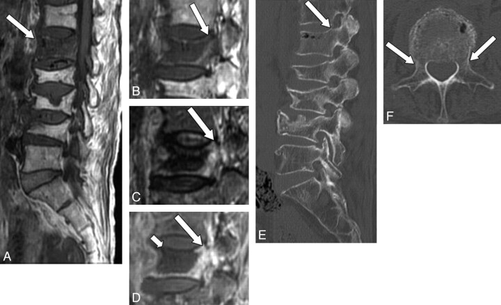 Fig 3.