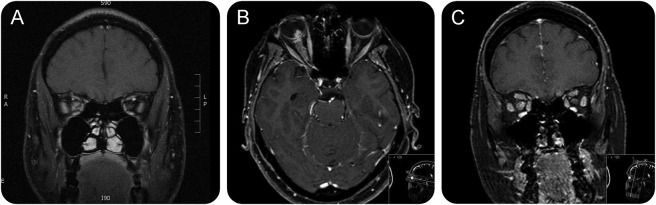 Figure 2.