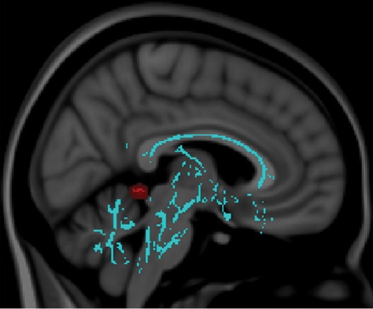 Figure 3b: