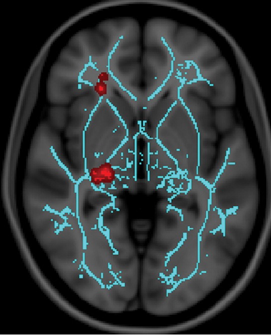 Figure 3c: