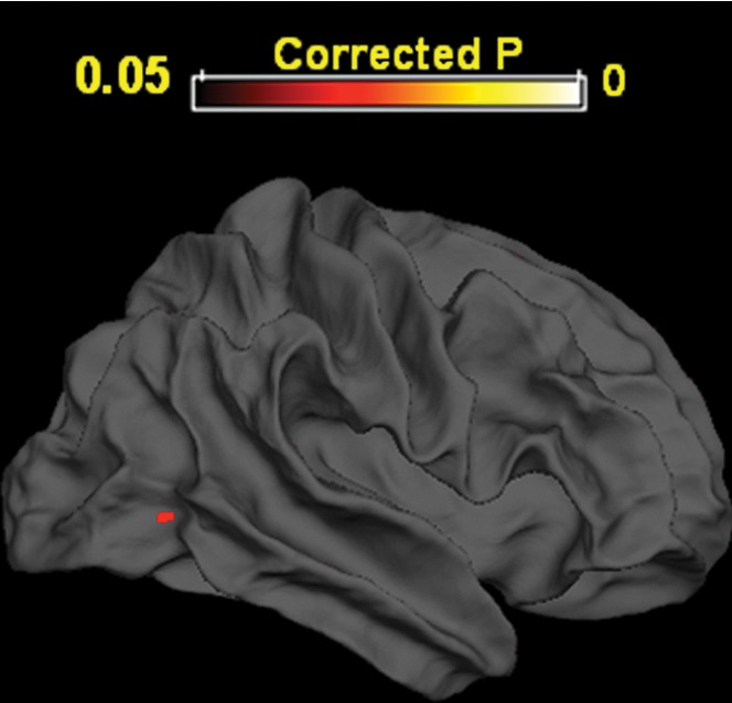 Figure 2d: