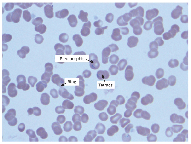 Figure 2:
