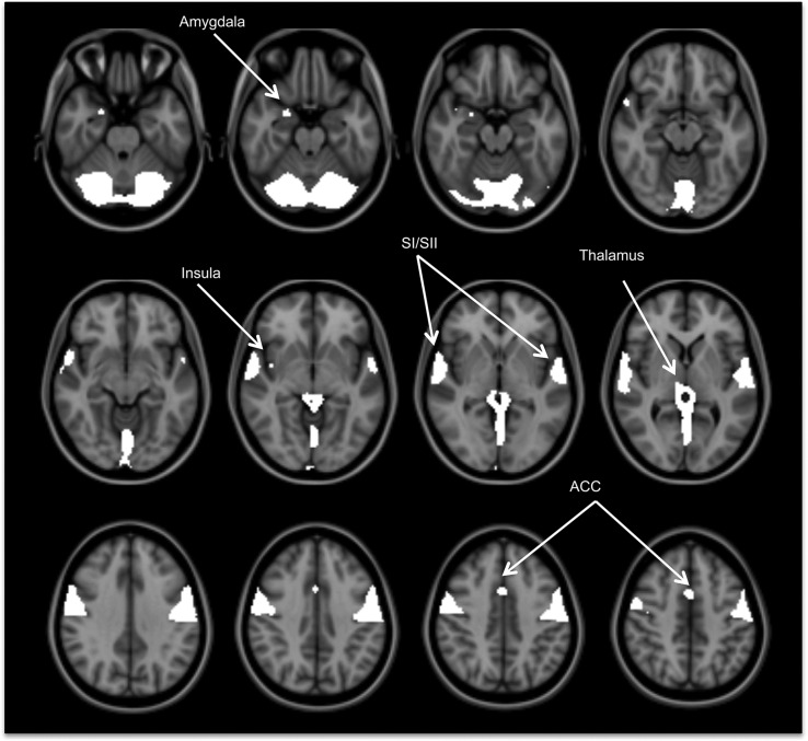 FIGURE 3