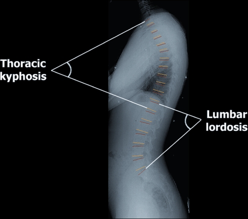 Fig. 2