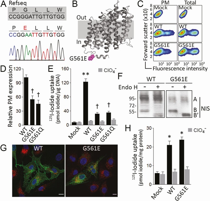 A Novel Slc5a5 Variant Reveals The Crucial Role Of Kinesin Light Chain 