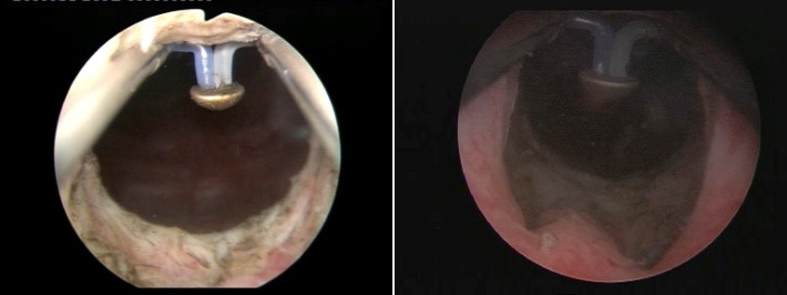 Fig. 5