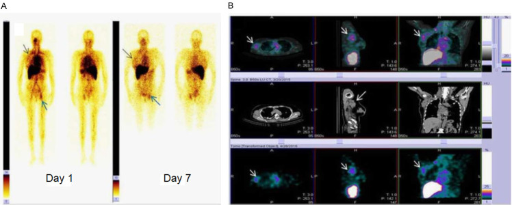 Figure 13