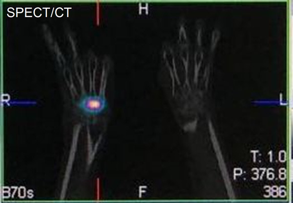 Figure 14