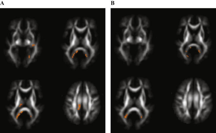 Fig.4