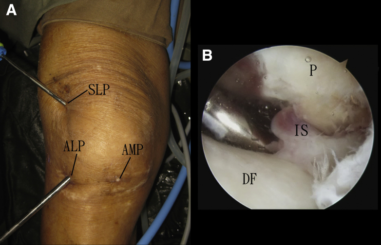 Fig 4