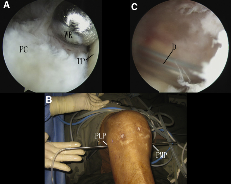 Fig 11