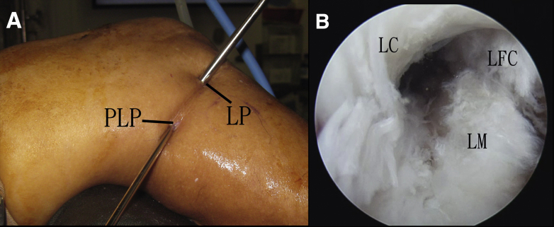 Fig 10