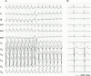 Figure 9: