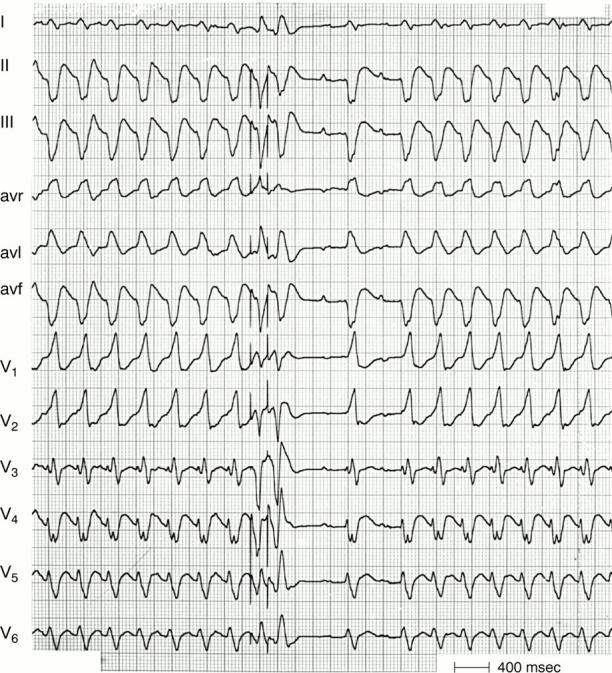 Figure 16:  