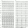 Figure 15: