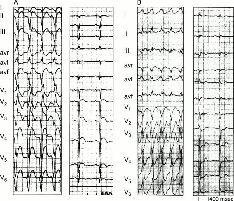 Figure 12:  