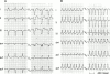Figure 11: