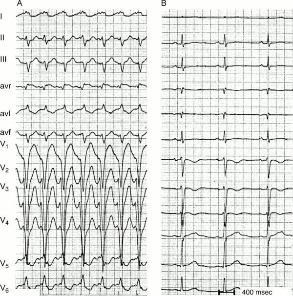 Figure 15:  