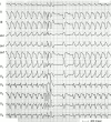 Figure 16: