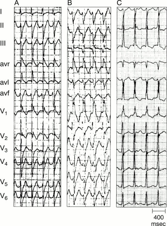 Figure 14:  