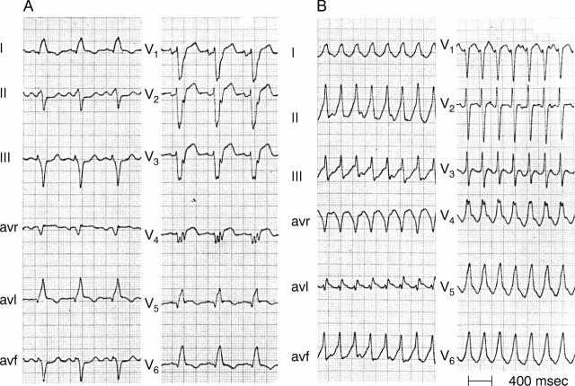 Figure 11:  