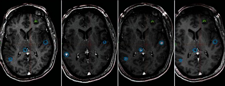 Figure 4